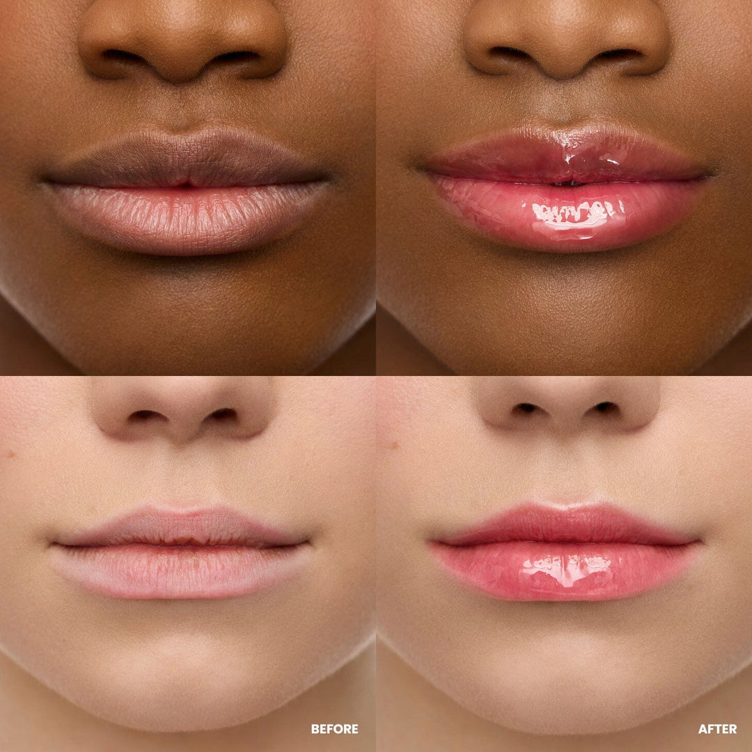 Wonderskin - Lip Rehab Serum Oil - Amour WS-LO-AMU - Amour Læbepleje 