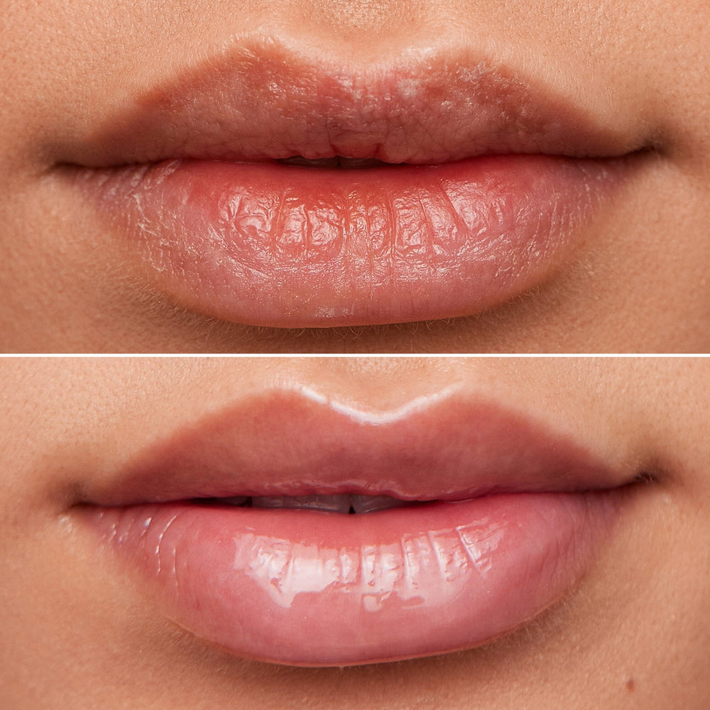 Wonderskin - Lip Rehab Therapy Oil - Clear - Læbepleje 